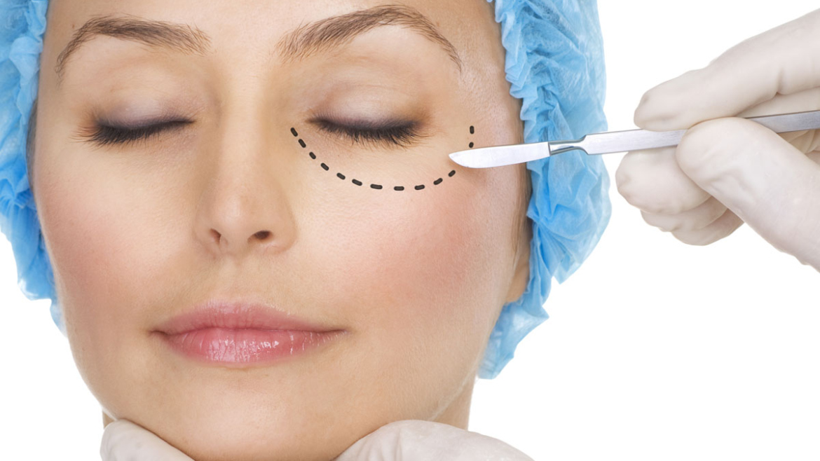 Blefaroplastia